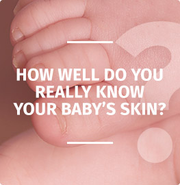 Conosci davvero la pelle del tuo bambino?